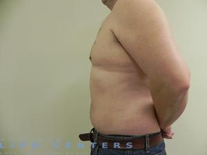 americanlipocenters_8.jpg